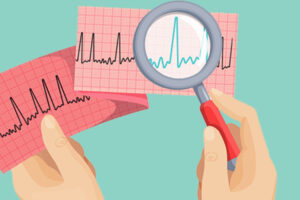 actioncards-vurdering-af-EKG